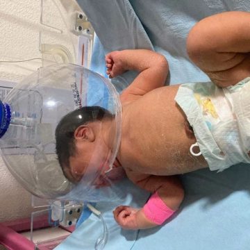 INDIGNACIÓN EN MÉXICO: MÉDICOS IMPROVISARON CAMPANA DE OXIGENACIÓN PARA RECIÉN NACIDO ANTE FALTA DE INSUMOS.