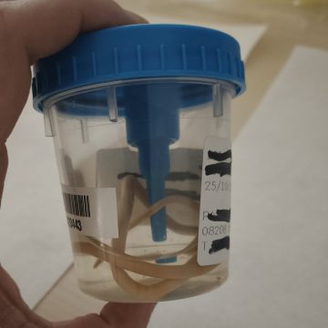 ¿QUÉ ES EL PARASITISMO? CONOZCA SÍNTOMAS, TRATAMIENTOS Y CONSECUENCIAS EN EL SALVADOR.