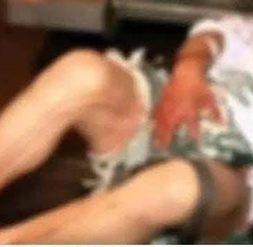 UNA MUJER LE CORTO EL PENE A SU ESPOSO PORQUE LE ENCONTRO MENSAJES DE OTRA MUJER.