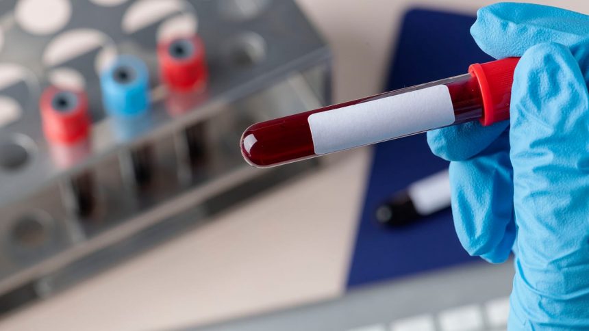 JAPÓN INICIA PRUEBAS DE SANGRE ARTIFICIAL UNIVERSAL EN HUMANOS