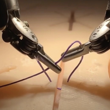 REVOLUCIÓN MÉDICA: ROBOT CON INTELIGENCIA ARTIFICIAL REALIZA CIRUGÍA COMPLETA SIN AYUDA HUMANA