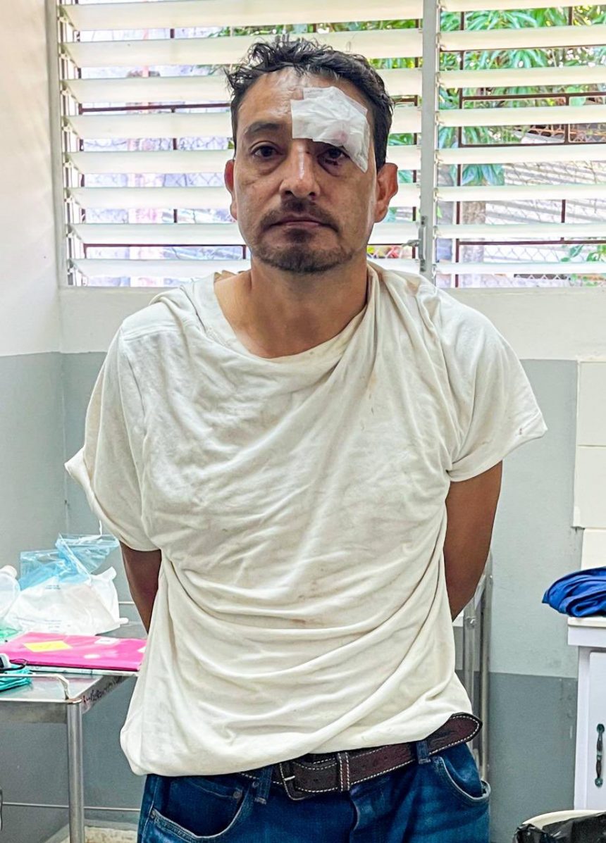 DOS CONDUCTORES SIN LICENCIA PROVOCAN ACCIDENTES GRAVES EN LA UNIÓN Y CUSCATLÁN