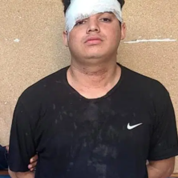 CONDUCTOR EBRIO CHOCÓ CONTRA UN MURO EN ZONA RESIDENCIAL DE SANTA ANA