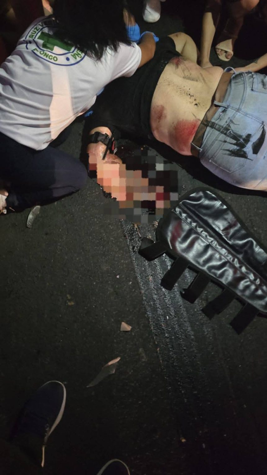 BUS DE LA RUTA 201 IMPACTA A MOTOCICLISTA Y SU ACOMPAÑANTE EN LA CARRETERA PANAMERICANA