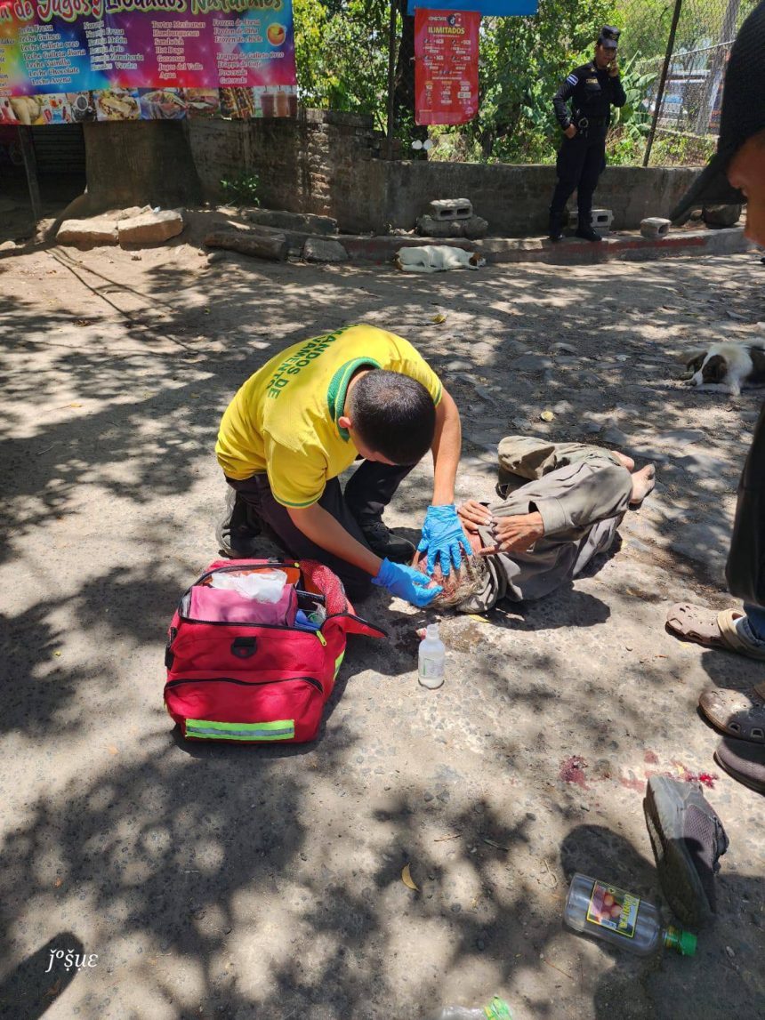 PERSONA RESULTA LESIONADA TRAS SER ATROPELLADA EN CARRETERA ANTIGUA A SANTA ANA