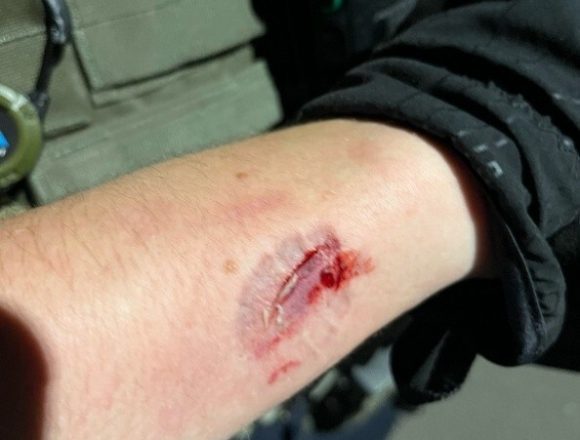 PERRO 3 DEPARTAMENTO DE JUSTICIA DE EE.UU PRESENTÓ CARGOS CONTRA MANIFESTANTE ACUSADO DE AGREDIR A AGENTES DE ICE EN NUEVA JERSEY