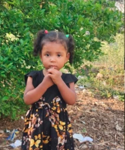 NIÑA 1 NIÑA DE 2 AÑOS PERMANECE EN ESTADO CRÍTICO TRAS SUFRIR MORDEDURA DE SERPIENTE EN HONDURAS