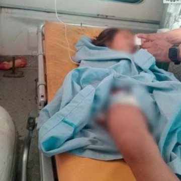 guate 2 NIÑA DE 4 AÑOS MUERE TRAS SER MORDIDA POR UNA SERPIENTE BARBA AMARILLA EN GUATEMALA