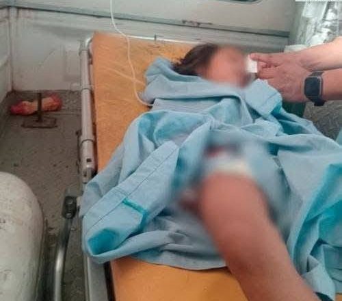 guate 2 NIÑA DE 4 AÑOS MUERE TRAS SER MORDIDA POR UNA SERPIENTE BARBA AMARILLA EN GUATEMALA