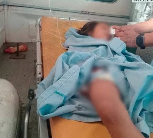 guate 2 NIÑA DE 4 AÑOS MUERE TRAS SER MORDIDA POR UNA SERPIENTE BARBA AMARILLA EN GUATEMALA