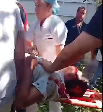 minitrab 2 TRES PERSONAS RESULTARON LESIONADAS TRAS CAÍDA DE ÁRBOL EN INSTALACIONES DEL MINISTERIO DE TRABAJO