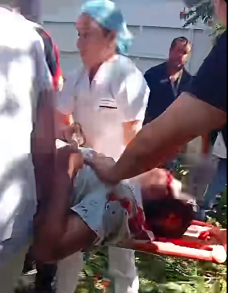 minitrab 2 TRES PERSONAS RESULTARON LESIONADAS TRAS CAÍDA DE ÁRBOL EN INSTALACIONES DEL MINISTERIO DE TRABAJO