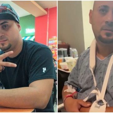 hispano HISPANO RESULTA CON VARIAS FRACTURAS DURANTE OPERATIVO DE ICE EN GEORGIA; SU FAMILIA DENUNCIA AGRESIÓN