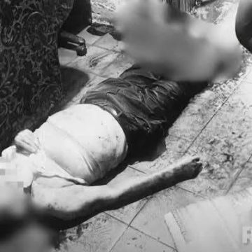 pero 1 PITBULL ATACA DOS VECES A SU DUEÑO Y LE CAUSA LA MUERTE EN TEGUCIGALPA